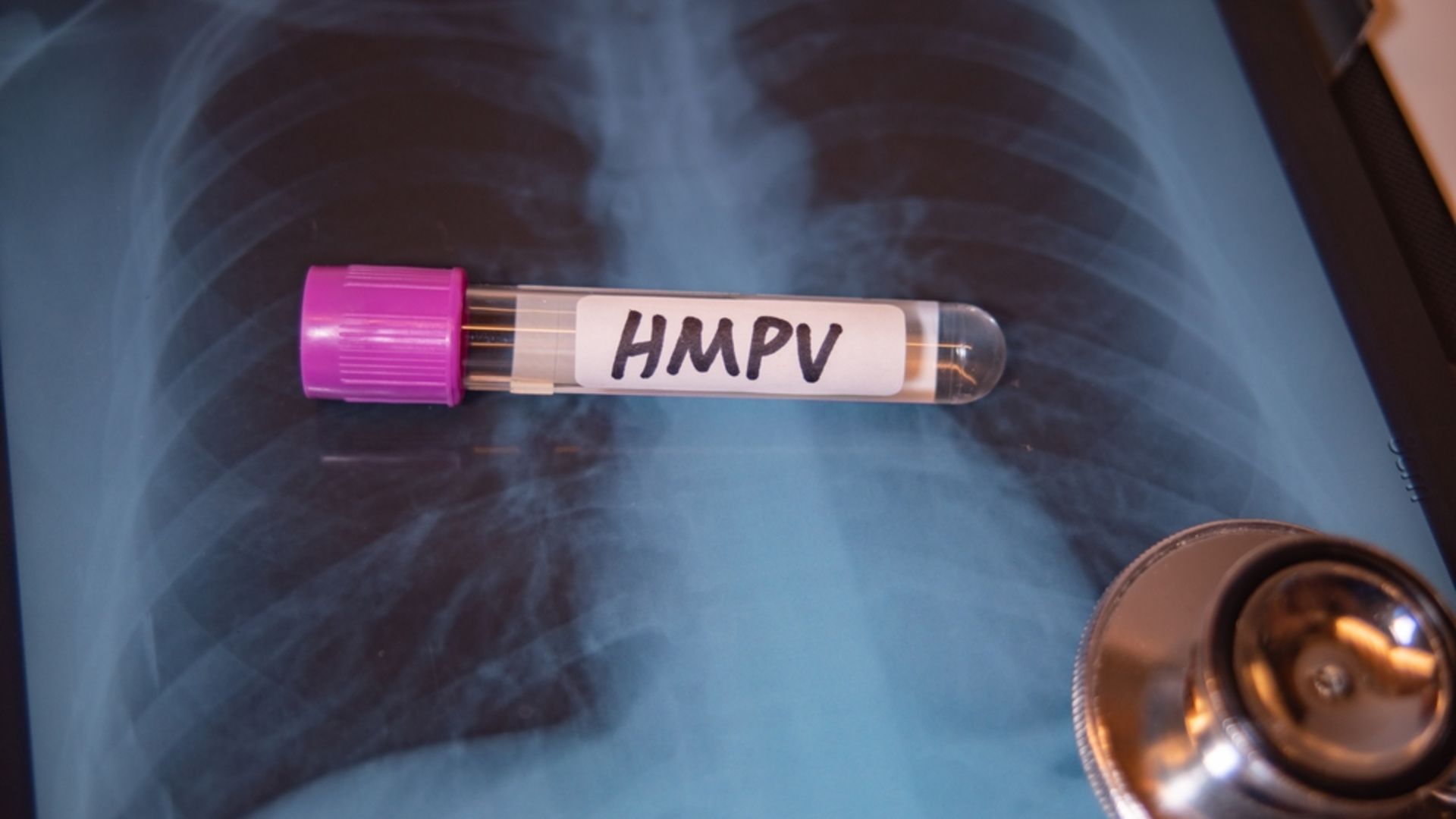 HMPV virüsü nedir?